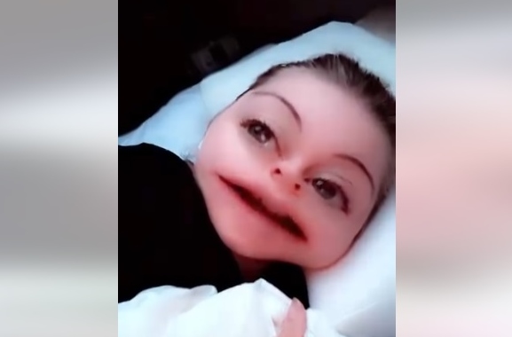 Gellumaskurin